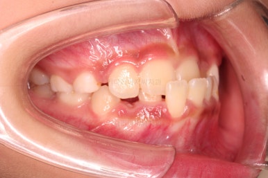 부산어린이교정