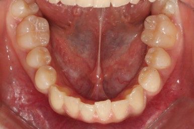 부산연산동청소년교정