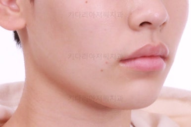 부산연산동치아교정