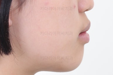 사직동교정치과