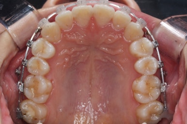 연산동교정치과