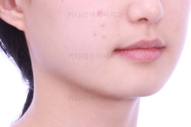 동래구치아교정