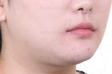부산치아교정