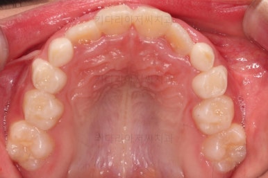 부산어린이교정