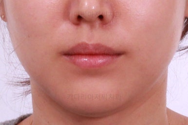 부산치아교정잘하는곳