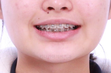 부산치아교정치과