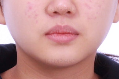 부산교정전문의