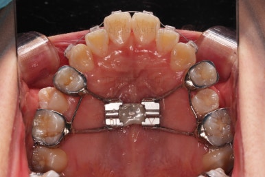 부산치아교정잘하는치과