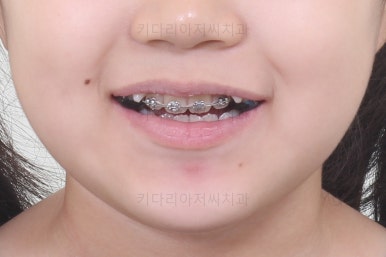 부산초등학생교정