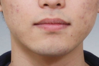 부산주걱턱교정