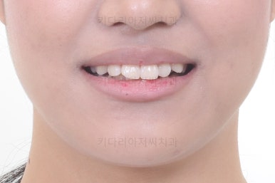 연산동치아교정치과