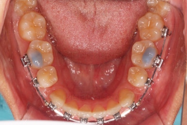 사직동교정치과