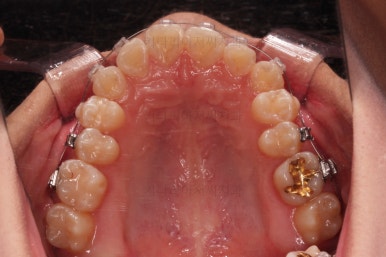 연산동치아교정치과