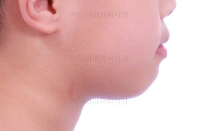 부산어린이교정