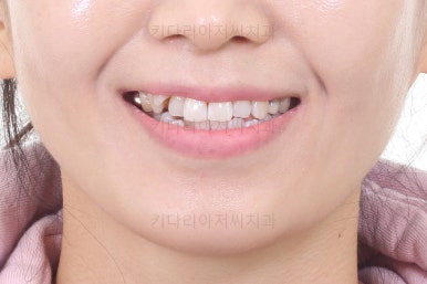 부산인비절라인