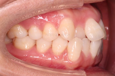 부산교정잘하는치과