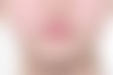 부산덧니교정