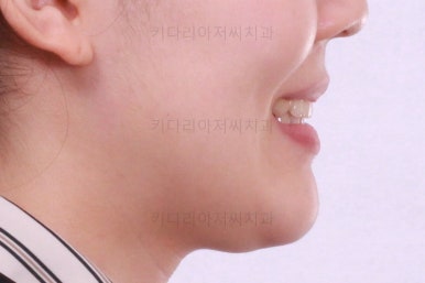 부산교정