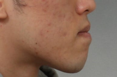 부산주걱턱교정