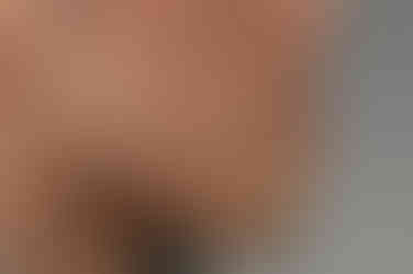 부산주걱턱교정