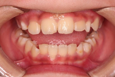 부산어린이교정