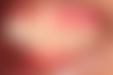 부산연산동치아교정