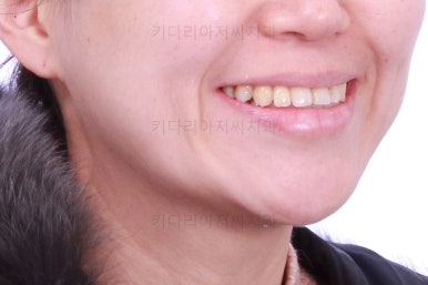 부산연산동치과