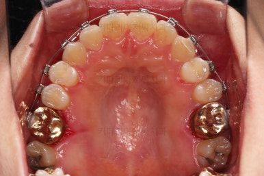 부산안면비대칭