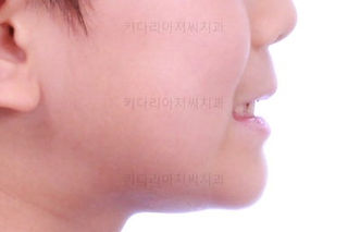 부산어린이교정