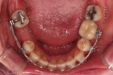 부산재교정치과