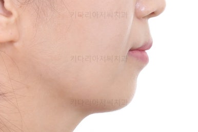 부산인비절라인