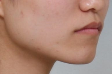 부산교정전문의