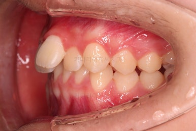 부산청소년교정치과
