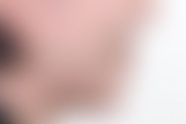 부산치아교정잘하는곳