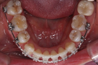 부산연산동교정치과