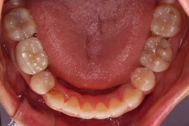 부산인비절라인