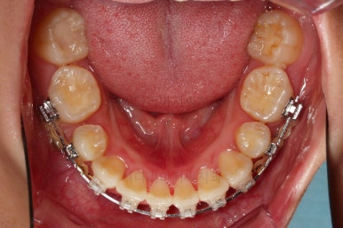부산무턱교정치과
