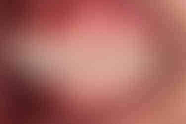 부산안면비대칭