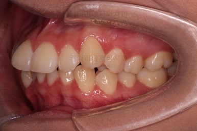 연산동치아교정치과