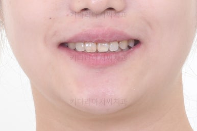 부산이교정