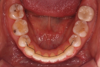 부산연산동교정치과