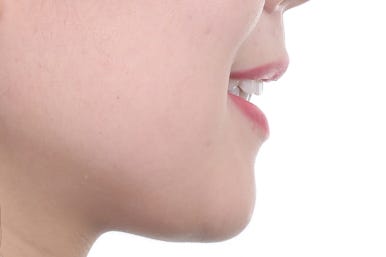 부산연산동교정치과