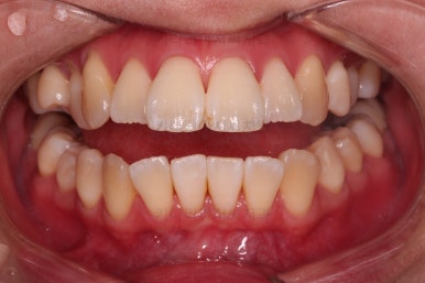 부산치아교정잘하는치과