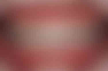 부산연산동교정치과