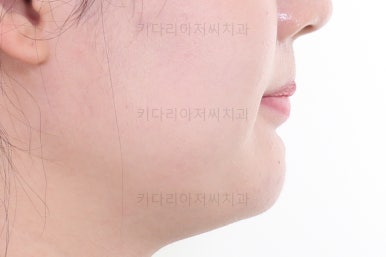 부산인비절라인