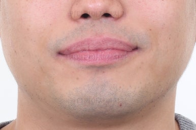 부산교정치과추천