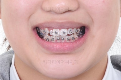 사직동교정치과