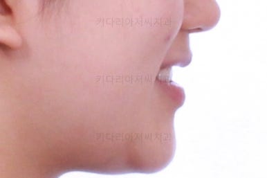 사직동교정치과