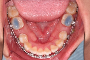 연산동치아교정치과