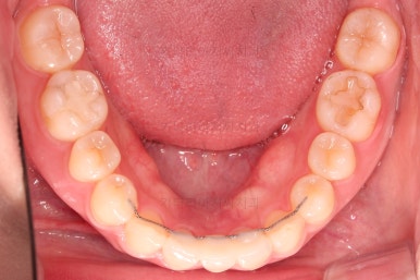 부산교정치과추천